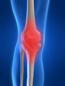 Knee pain knee arthritis